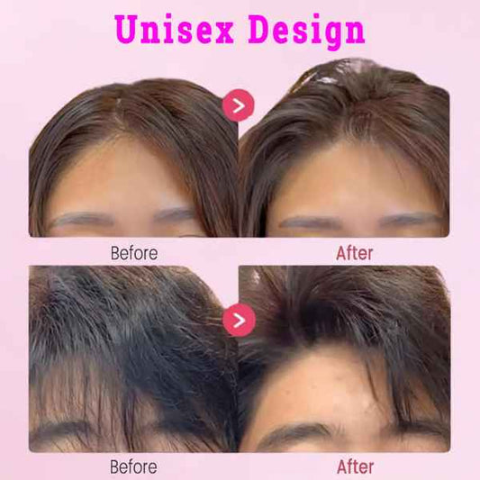 Women’s No-Mark Crown Volumising Hair Root Clip