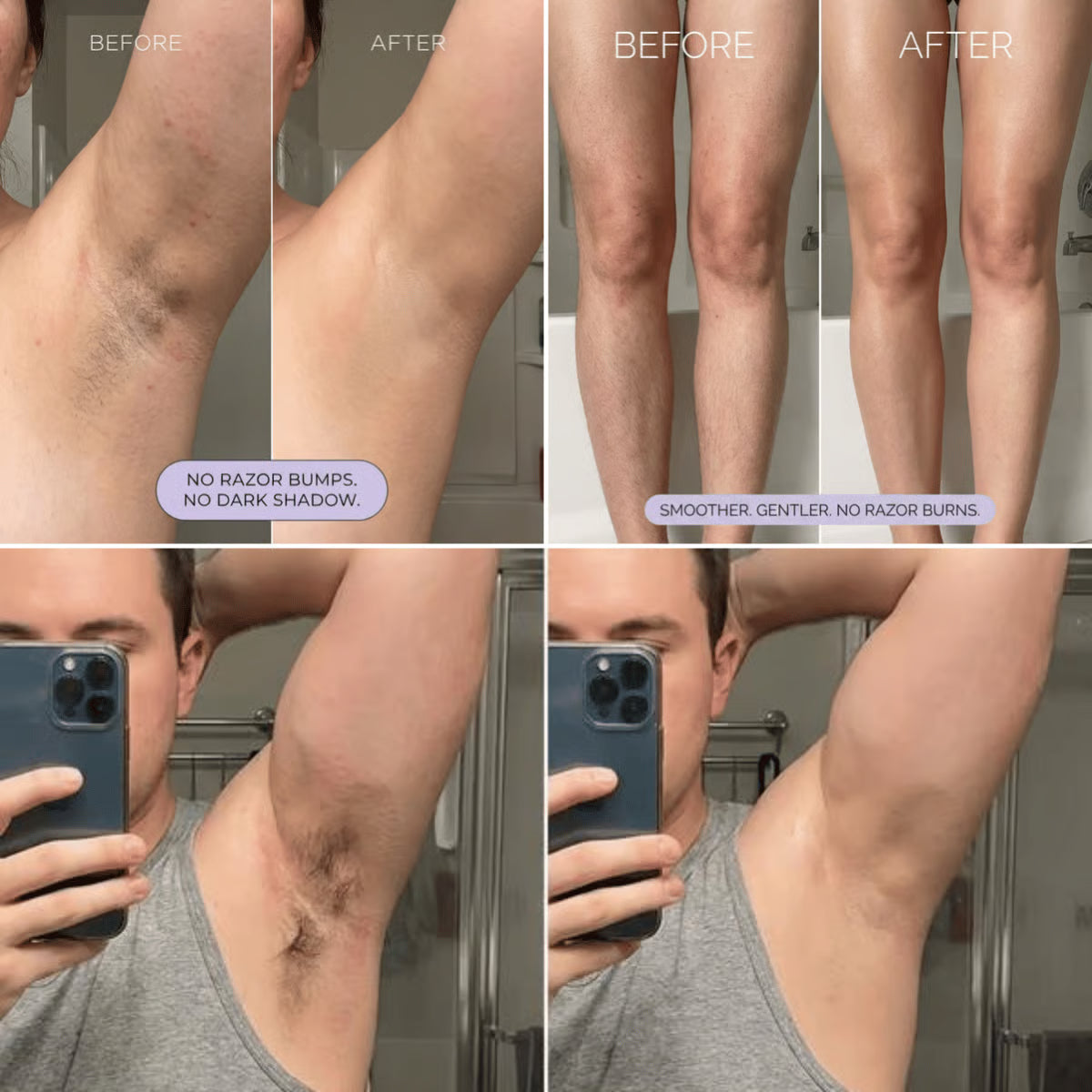 Body Hair Removal Mousse